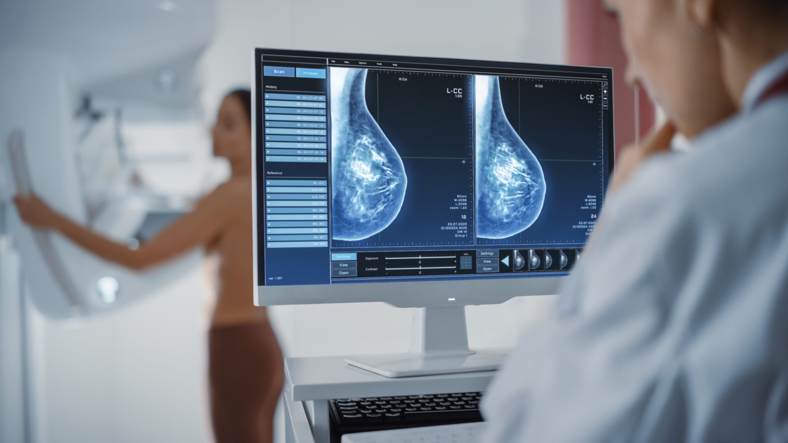 Qué beneficios tiene la mamografía?